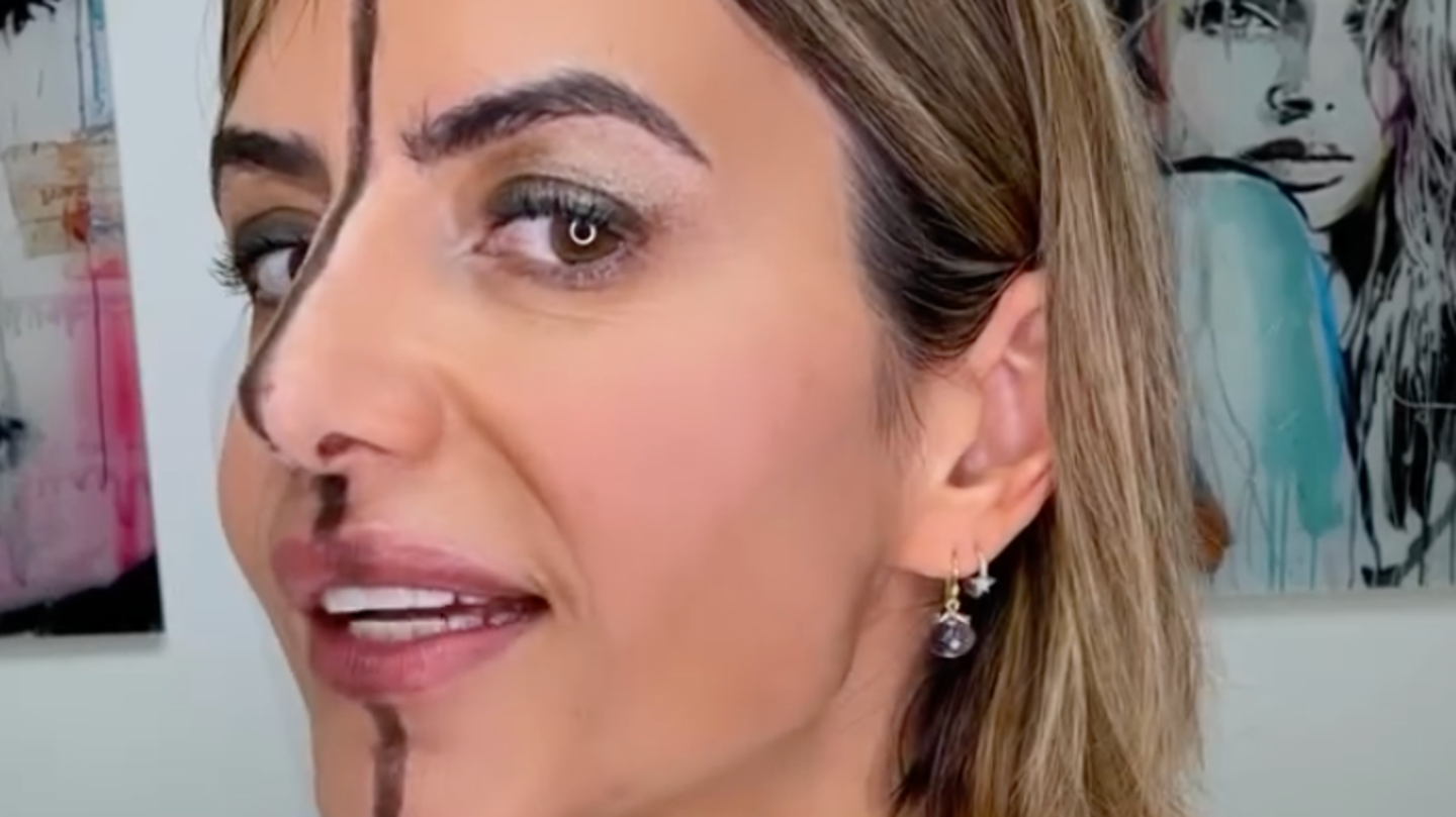 Doctor injects Botox into one side of her face and reveals shocking effects