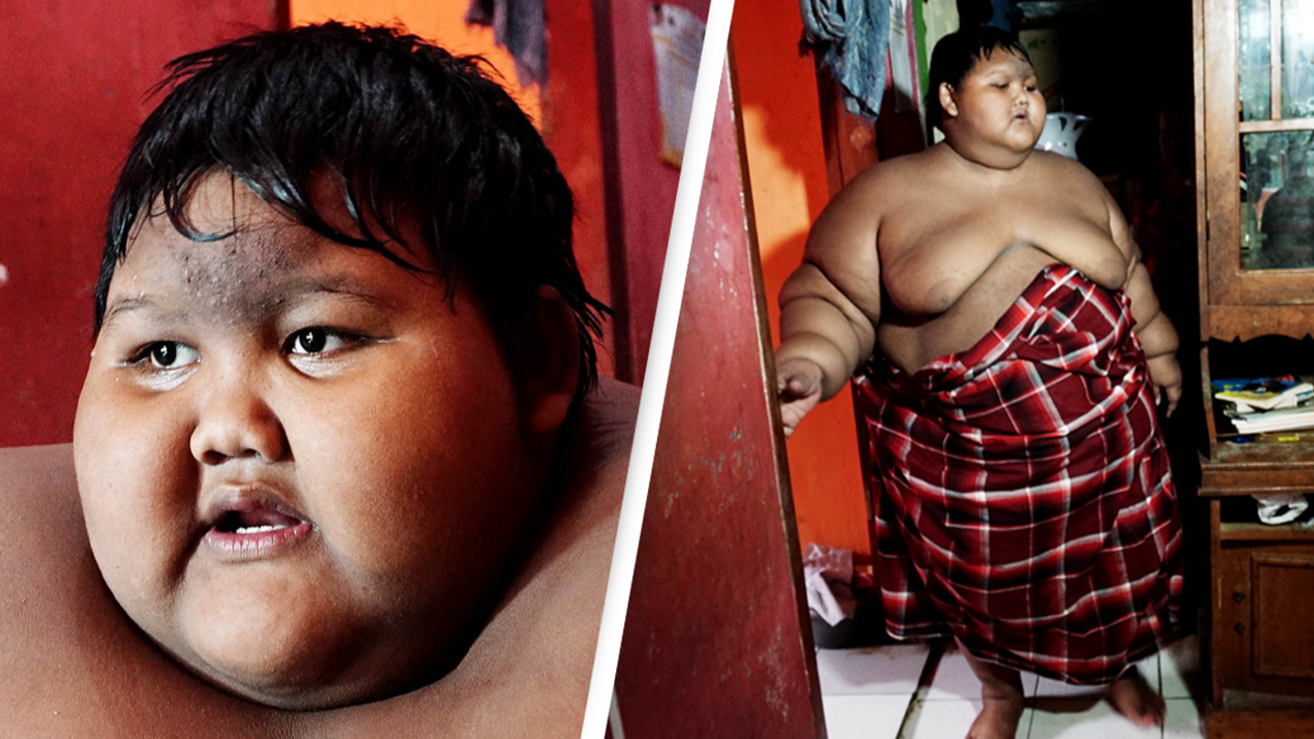Former 'world's fattest boy' looks completely unrecognizable after losing half his weight