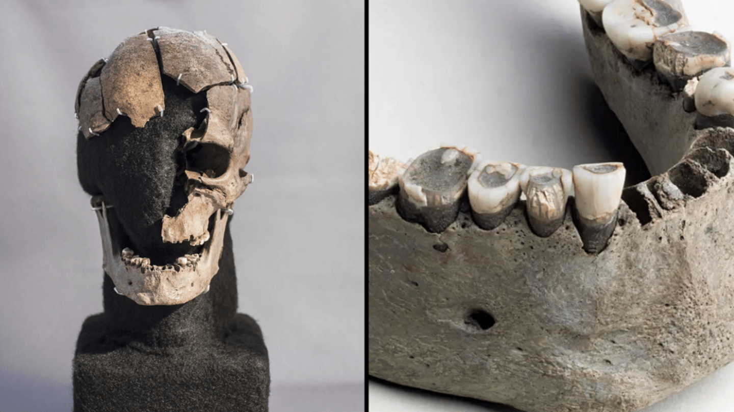 Ancient man so well preserved that scientists think they know what he ate before violent death - Vimarsana News