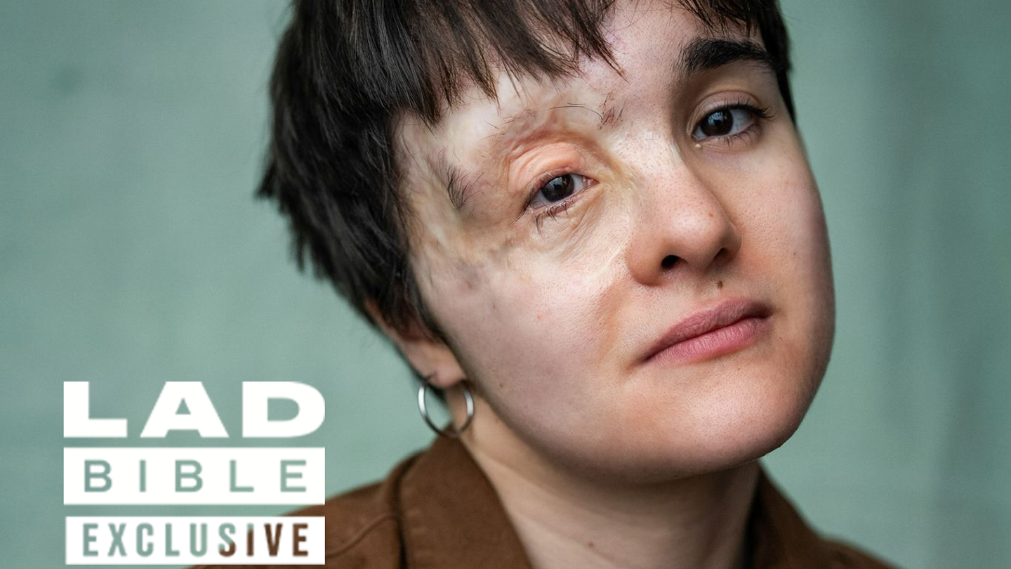 Halloween et troubles psychologiques: témoignage poignant