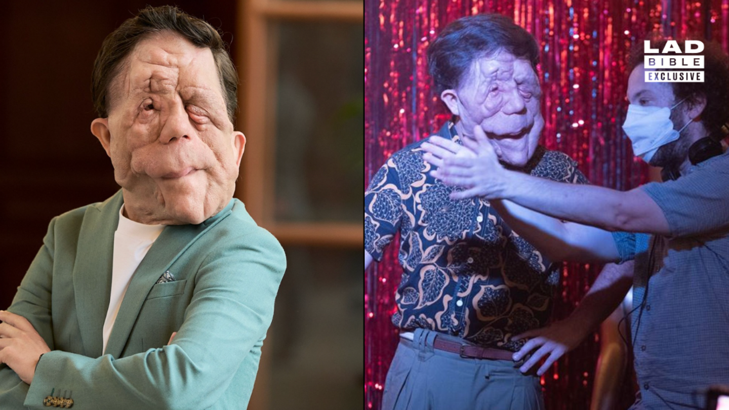 A Different Man : Adam Pearson renaît en tant qu’acteur