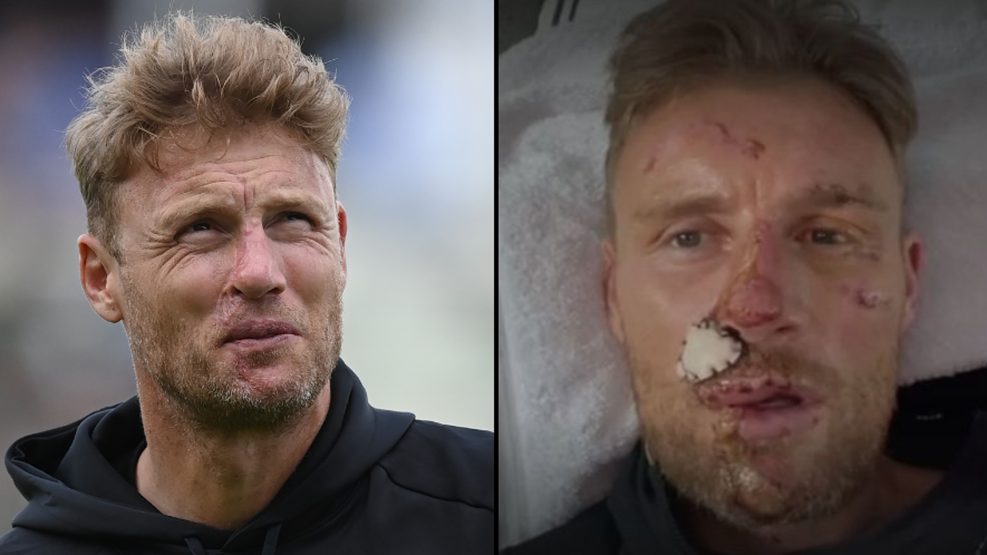 Excuses BBC et indemnisation suite à l’accident terrifiant de Freddie Flintoff sur Top Gear