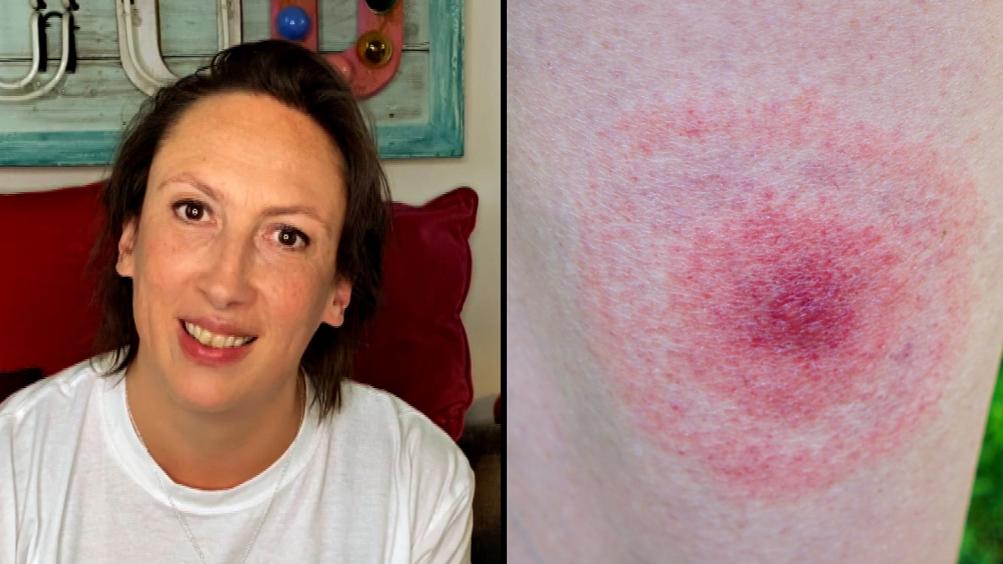 Miranda Hart révèle les symptômes de la maladie de Lyme qui l’ont laissée clouée au lit